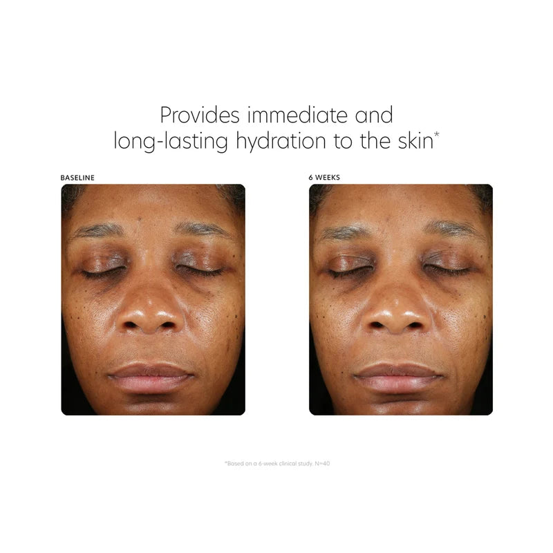 PCA Skin Hyaluronic Acid Boosting Serum | Advanced Hydrating Face Serum 30ml
